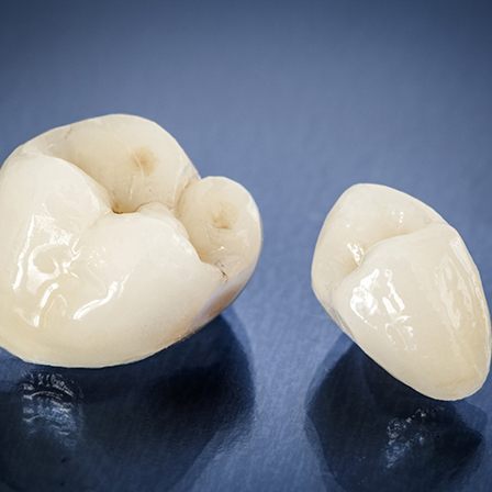 Two all ceramic dental crowns on blue background