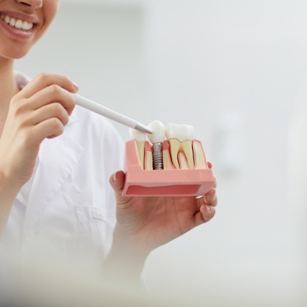 Dentist showing a dental implant model to a patient