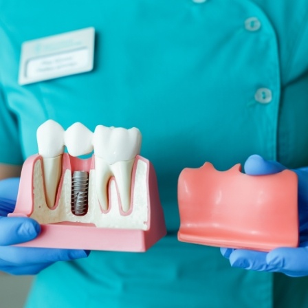 Dentist holding two models of the jaw one with a dental implant