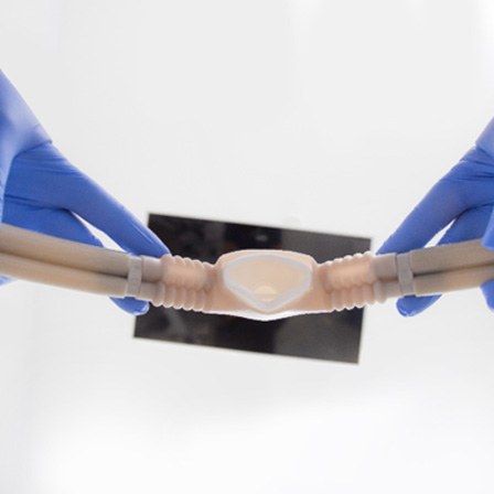 Dental team member holding nitrous oxide mask