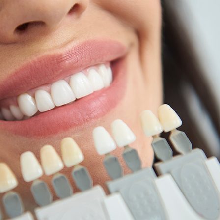 Dentist placing shade scale against patient's smile